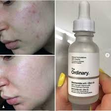 The Ordinary Niacinamide